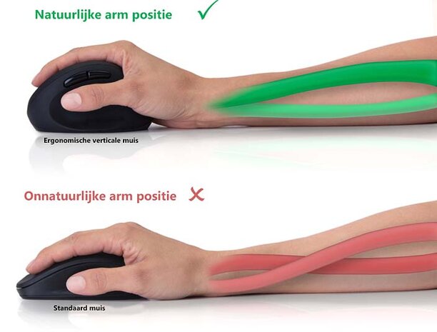 Ergonomische  Armsteun - 1 Draaipunt - Lengte onderarmkussen: 40 - Max. draagvermogen: 5 kg - Zwenkhoek: 360 ° - Met muisplatform